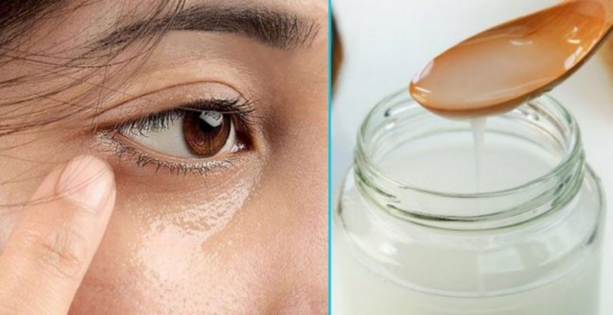 Dầu dừa có thể giúp làm mờ nếp nhăn?