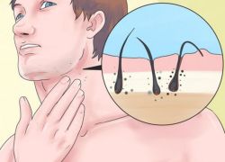 Làm thế nào để râu mọc nhanh hơn?