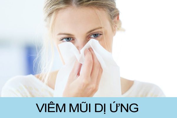 Cách chữa viêm mũi dị ứng tại nhà cực hiệu nghiệm ai cũng nên thử 1 lần 