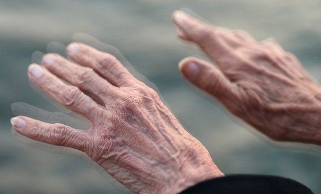 Bệnh Parkinson là căn bệnh liên quan tới thần kinh và run tay là biểu hiện rõ nhất