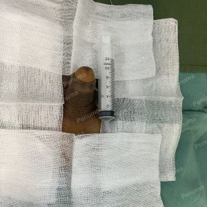 Tăng kích thước cậu bé bằng tấm độn megaderm, đường mổ ở mu, khách hàng 39 tuổi, Hà Nội - ca 151