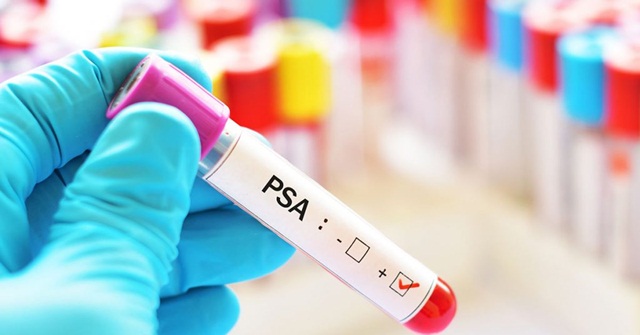 Xét nghiệm PSA (kháng nguyên đặc hiệu tuyến tiền liệt) cho biết điều gì?