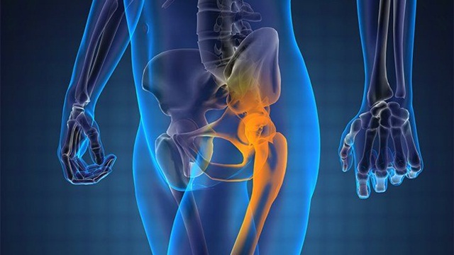 Ung thư tuyến tiền liệt di căn xương: Dấu hiệu, điều trị và tiên lượng