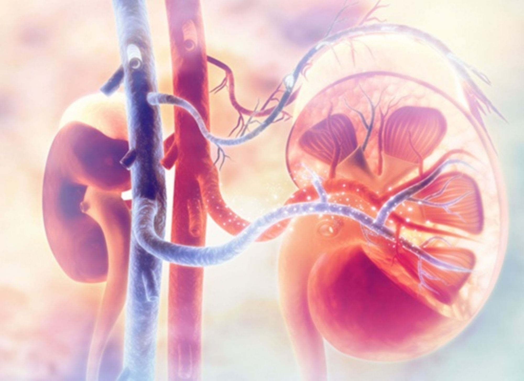 Mối liên hệ giữa bệnh đa u tủy và suy thận