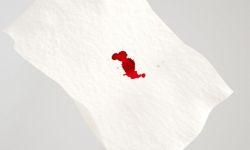 Tiểu ra máu khi bị nhiễm trùng đường tiết niệu có nguy hiểm không?