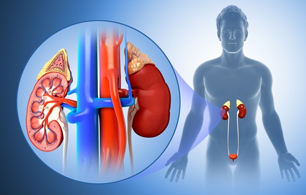 U lympho thận: Nguyên nhân, triệu chứng và điều trị