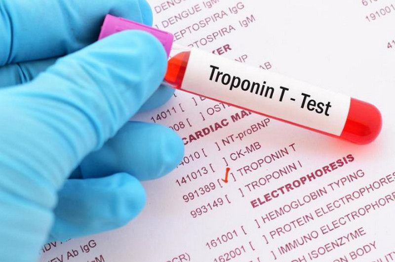 Chỉ số xét nghiệm Troponin bình thường