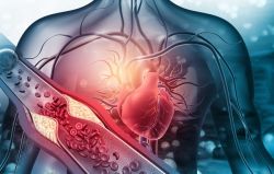 Cholesterol cao: Nguyên Nhân, Triệu Chứng Và Các Phòng Ngừa