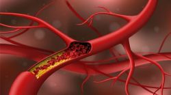 Cholesterol Là Gì? Những Lưu Ý Bạn Cần Biết