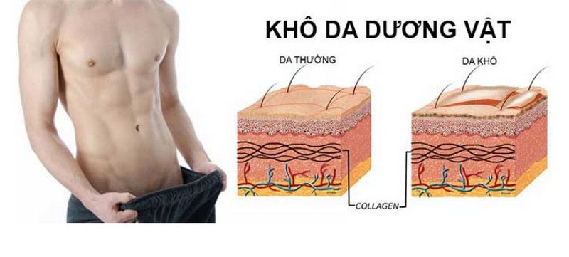 Da dương vật bị khô