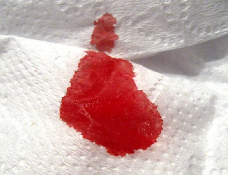 Màu máu kinh loãng