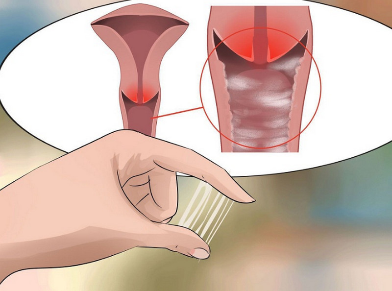Nhuộm soi dịch sinh dục
