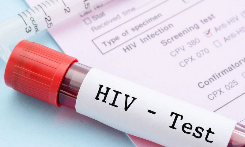 Xét nghiệm HIV ở nam giới