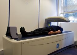Đo mật độ xương bằng phương pháp DEXA