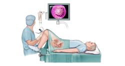 Nội soi bàng quang có phát hiện được ung thư bàng quang không?