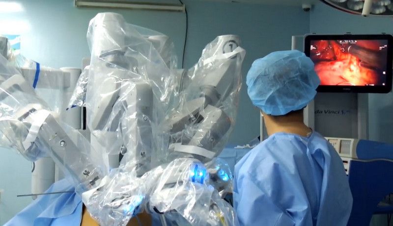 Quy trình cắt thận bằng robot