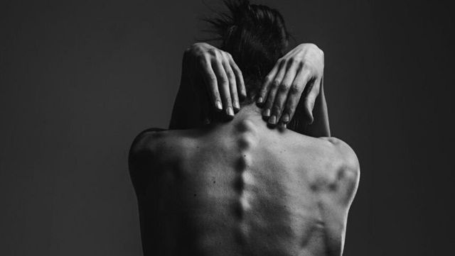 Chứng chán ăn có thể làm tăng nguy cơ loãng xương