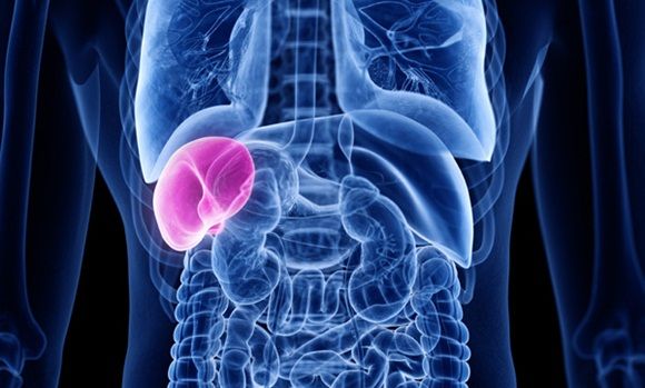 Mối liên hệ giữa bệnh Gaucher và loãng xương