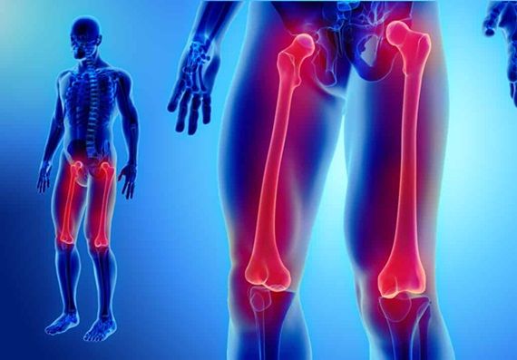 Gãy thân xương đùi điều trị bằng cách nào?