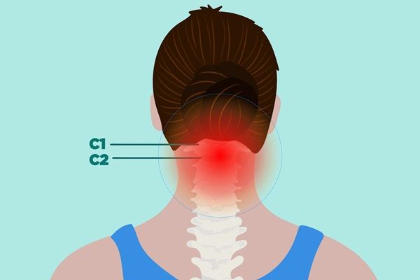 Viêm khớp dạng thấp ở cổ: Triệu chứng và cách điều trị