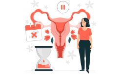 Mãn kinh ở độ tuổi 20: Nguyên nhân và cách điều trị