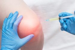 Điều trị viêm khớp dạng thấp bằng steroid: Hiệu quả và rủi ro