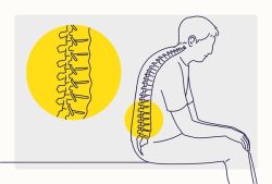 Sự khác biệt giữa viêm khớp dạng thấp và viêm cột sống dính khớp