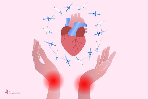 Người bị viêm khớp dạng thấp có nguy cơ suy tim cao hơn