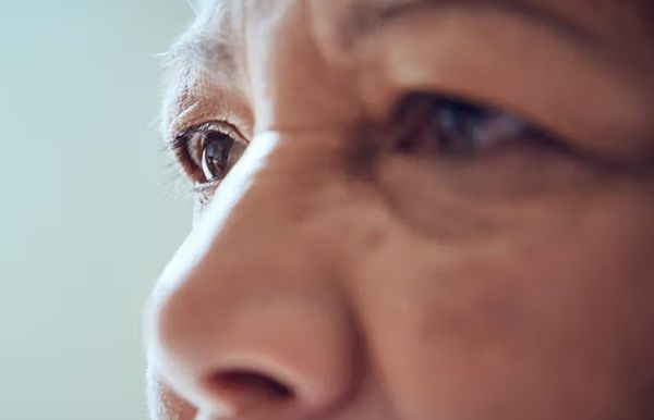 Bệnh viêm khớp ảnh hưởng như thế nào đến mắt?