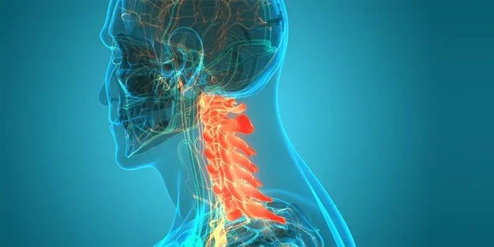 Đột quỵ tủy sống có tiên lượng ra sao?