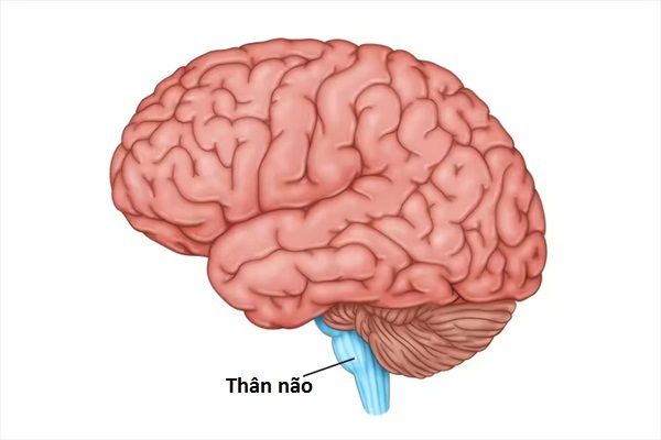 Đột quỵ thân não: Triệu chứng và tiên lượng