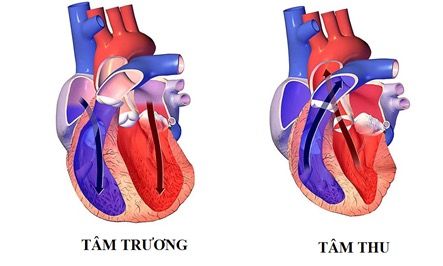 Sự khác biệt giữa suy tim tâm thu và suy tim tâm trương