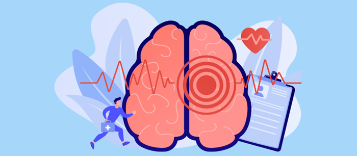 Stress có thể dẫn đến đột quỵ