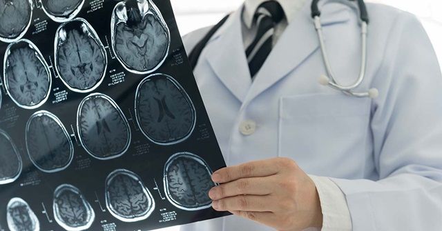 Làm thế nào để tầm soát đột quỵ?