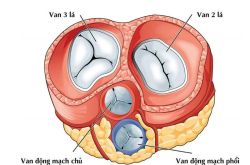 Bệnh van tim: Triệu chứng và cách điều trị