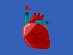 Hội chứng Dressler là gì? Có nguy hiểm không?