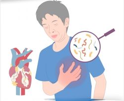 Viêm nội tâm mạc nhiễm khuẩn bán cấp là gì?