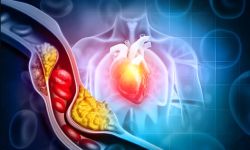 6 cách giúp làm giảm cholesterol mà không cần dùng thuốc