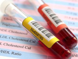 Xét nghiệm cholesterol lipoprotein tỷ trọng cao (HDL) là gì?
