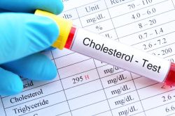 Cholesterol 250 mg/dL có cao không?