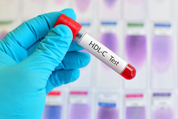 HDL cholesterol quá cao có gây hại không?