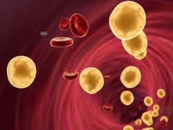 Rối loạn lipid máu: Cholesterol và triglyceride trong máu cao