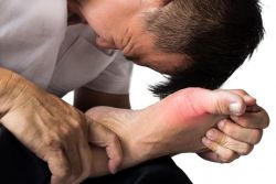 Bệnh gout (gút): Nguyên nhân, triệu chứng và cách điều trị