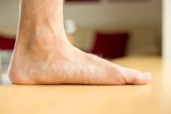 Bàn chân bẹt điều trị bằng cách nào?