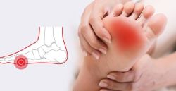 Nguyên nhân gây đau xương đốt bàn chân