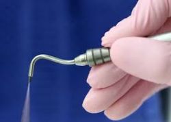 Áp lực khí: chăm sóc nha khoa mà không cần khoan