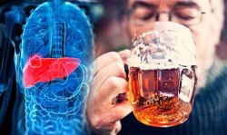 Bệnh gan do rượu: Triệu chứng, cách điều trị và biến chứng