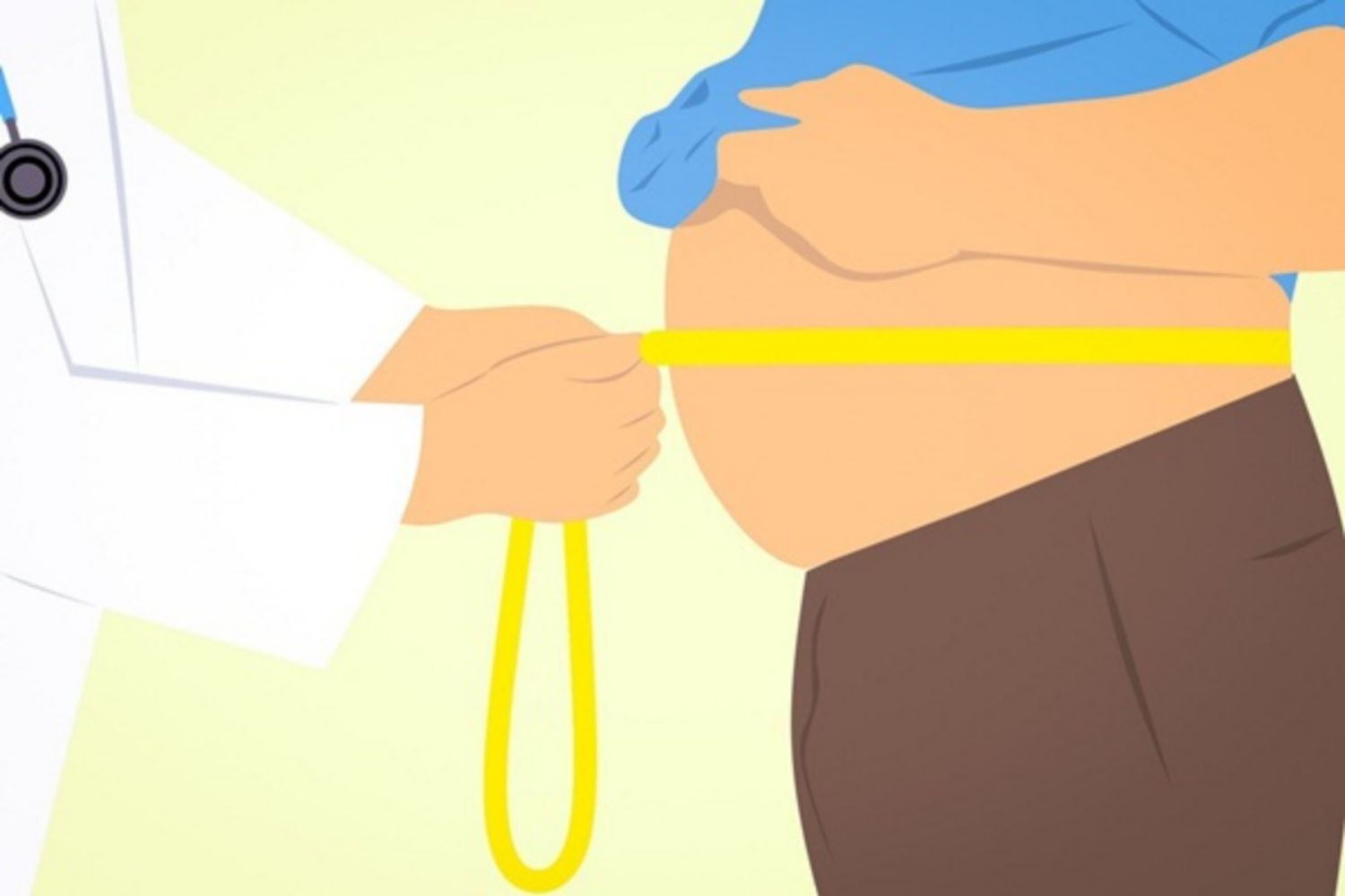 Bệnh béo phì: Nguyên nhân, cách điều trị và ngăn ngừa