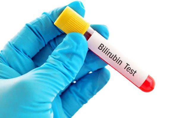 Xét nghiệm bilirubin máu để làm gì?