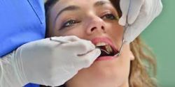 Cách chỉnh sửa răng bị mẻ hoặc vỡ